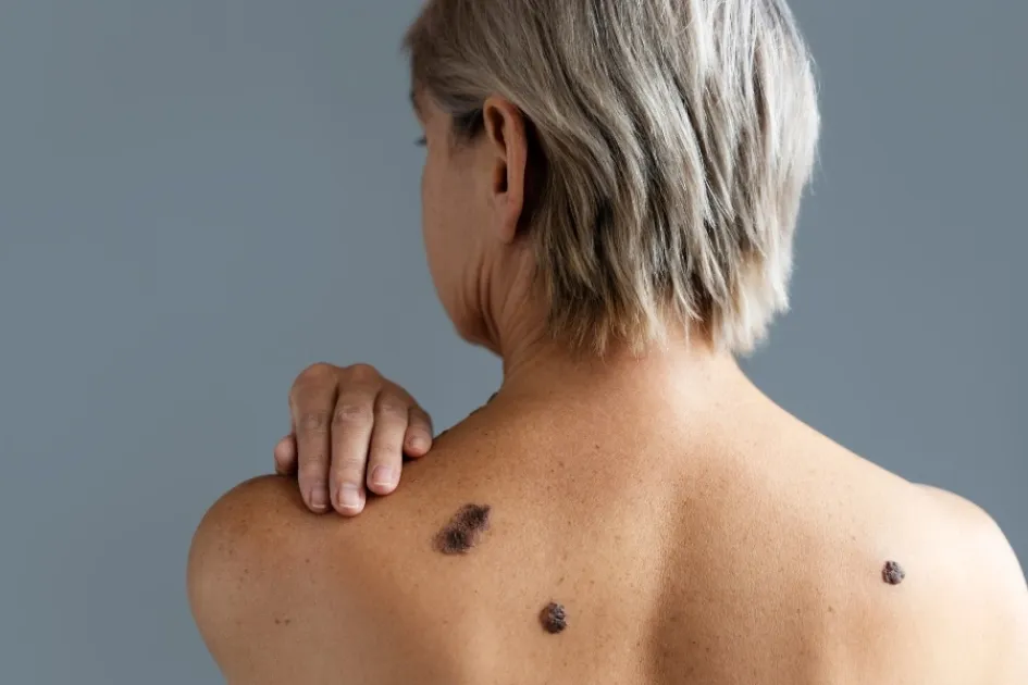 Estar atento a posibles signos de riesgo para atacar a tiempo el cáncer. Estar atento a posibles signos de riesgo para atacar a tiempo el cáncer.