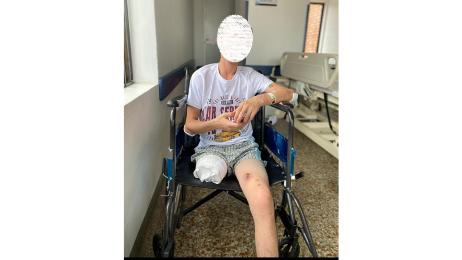 Al muchacho debieron amputarle la pierna por encima de la rodilla. Espera recuperar el movimiento de la izquierda. Al muchacho debieron amputarle la pierna por encima de la rodilla. Espera recuperar el movimiento de la izquierda.