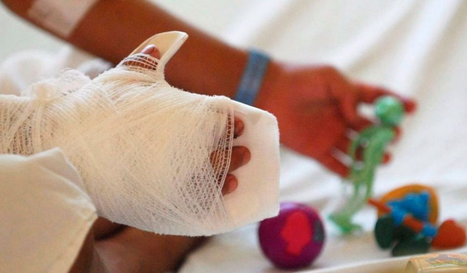 Un niño de dos años y un adulto de 30 resultaron quemados por pólvora en Salamina Un niño de dos años y un adulto de 30 resultaron quemados por pólvora en Salamina