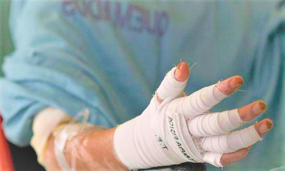 Tres personas, de 31, 38 y 36 años, sufrieron quemaduras por utilizar pólvora en Manizales y San José (Caldas). Tres personas, de 31, 38 y 36 años, sufrieron quemaduras por utilizar pólvora en Manizales y San José (Caldas).