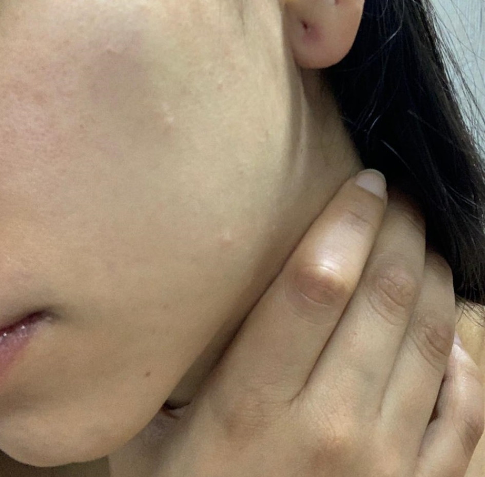 La joven agredida recibió una incapacidad de 10 días. La joven agredida recibió una incapacidad de 10 días.